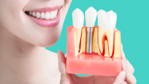 Dental Members Springwood / Treatment Plan - Dental Members Springwood / Take advantage of endorsed, discounted business products.